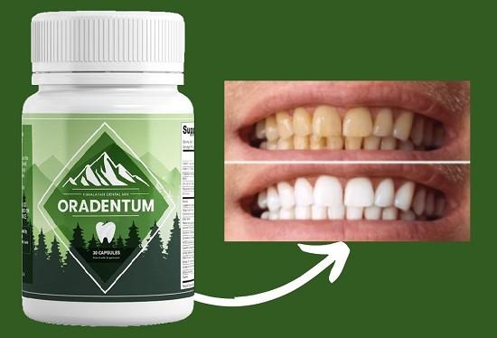 Oradentum Review